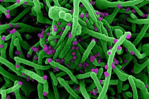 Novel_Coronavirus_SARS-Cov-2_(50010217143) (1)