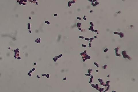 Streptococcus_agalactiae_Gram_staining_of_culture