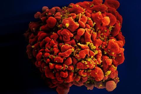 HIV-infected_H9_T_Cell_(6813314147)