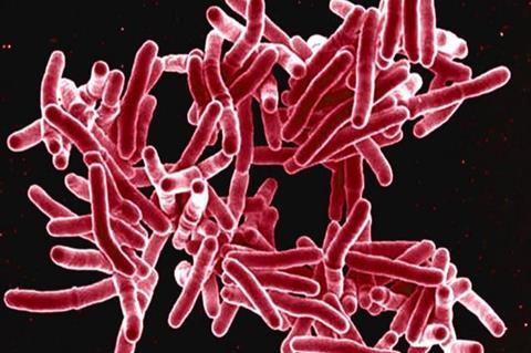 Tuberculosis