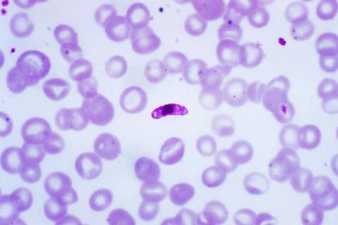 <i>Plasmodium falciparum</i> macrogametocyte