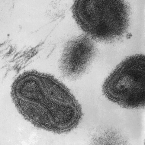 1080px-Smallpox_virus_virions_TEM_PHIL_1849_(crop)