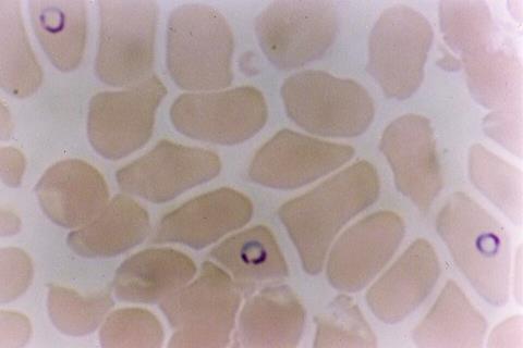 Plasmodium_falciparum_in_Red_Blood_Cells
