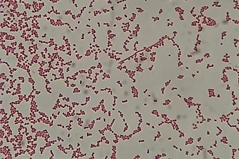 Gram_-negative_cocci_(GNC)_and_Gram_-negative_rod_(GNR)_of_Acinetobactet_baumannii_in_Gram_staining