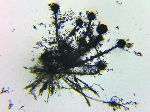 Microscope_view_of_Aspergillus_flavus_fungus_14