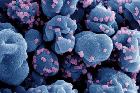 Novel_Coronavirus_SARS-CoV-2_070124