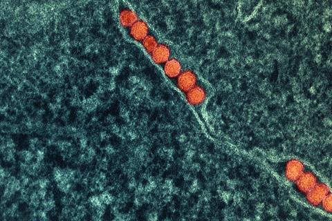 West_Nile_Virus_(52273319797)