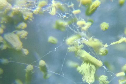 Microscope_view_of_Aspergillus_flavus_growing_on_a_leather_sample_27