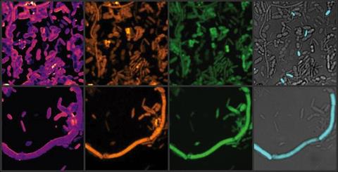 Chemical imaging of active gut microbes. After brief incubation with heavy water, culture medium and a drug, various chemical bonds (here C-D and C-H) in the stool sample are shown in yellow and green, their ratio in yellow-purple (left).