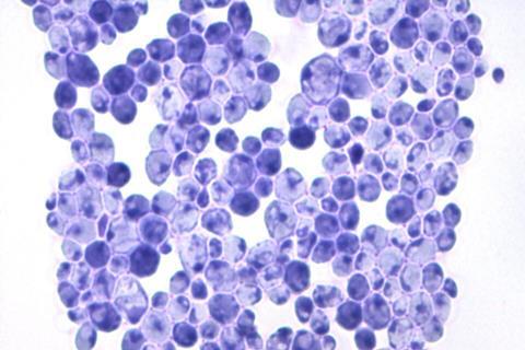 Asco_Candida_albicans