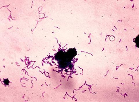 Streptococcus_mutans_01