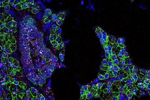 Salivary_Gland_Cells_infected_with_SARS-CoV-2_(51105883890)