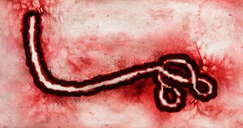 The_zoomed_out_ebolavirus_of_the_DRC_2026_OUTBREAK.webp