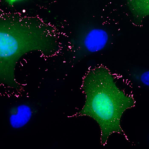 Low-Res_ANDV(green)_PCDH1(pink) 1 1