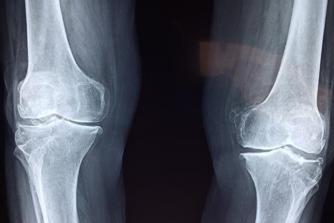 knee-2253047_1920