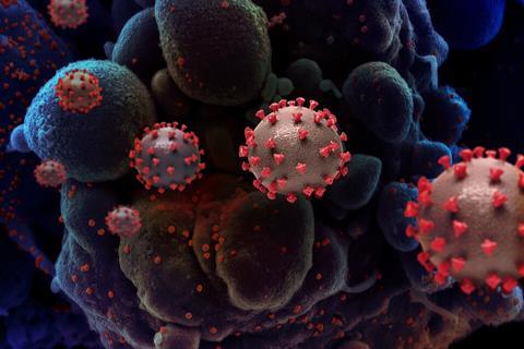 Novel_Coronavirus_SARS-CoV-2_(50047466123) (1)