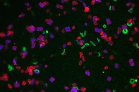 <i>Salinibacter ruber</i> cells