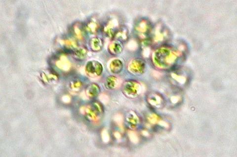 Microcystis_aeruginosa