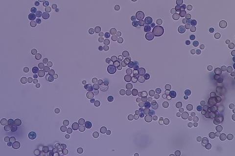 Cryptococcus_in_India_Ink