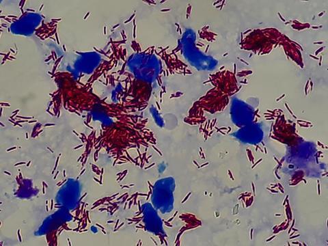 <i>Mycobacterium leprae</i> bacteria