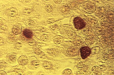 Chlamydia_trachomatis.tif