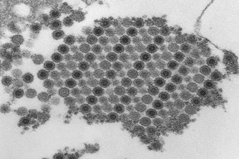 Chikungunya_virus_particles-PHIL-17369 (1)
