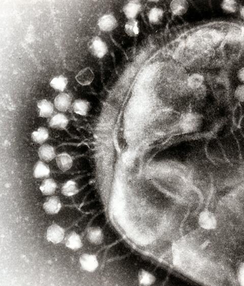 Phage attached to cell wall