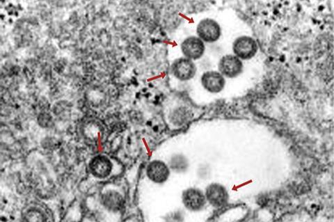 544px-Rift_Valley_Fieber_Virus