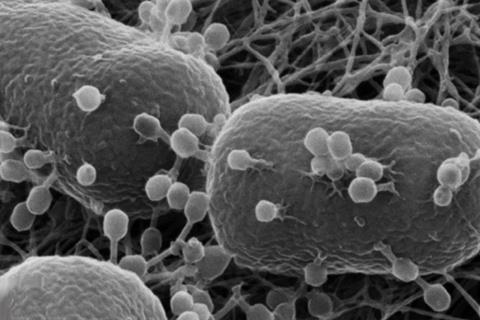 Escherichia_coli_with_phages