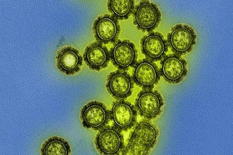 H1N1_Influenza_Virus_Particles_(8411599236)