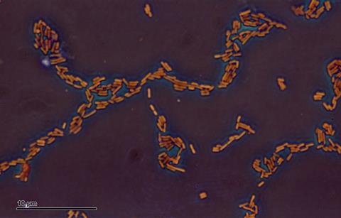 Escherichia_coli_(259_03)_Gramnegative_rods