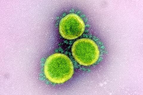 Novel_Coronavirus_SARS-CoV-2_(49640655213)