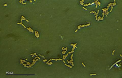 Escherichia_coli_(257_06)_Gramnegative_rods
