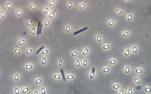 Low-Res_Endospore Bacillus (CCA-SA 3.0 Geoman3)