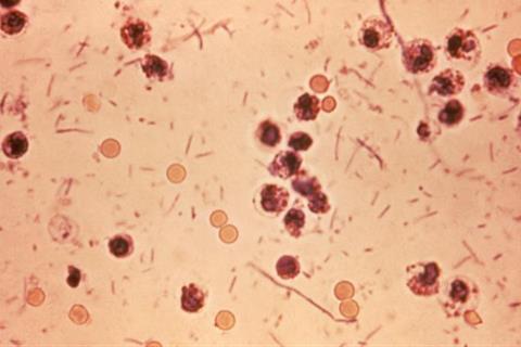 Shigella_stool