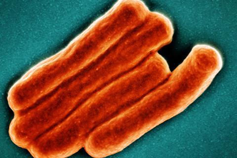 Mycobacterium_Tuberculosis_Bacteria,_the_Cause_of_TB_(52766648105)