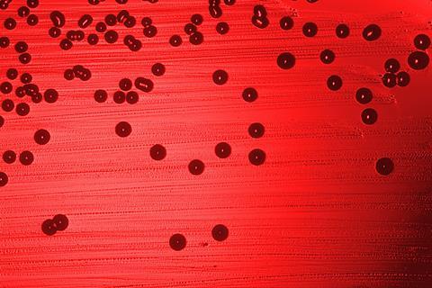 Haemophilus_influenzae_01
