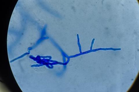 Low-Res_CWB_structure_under_the_microscope