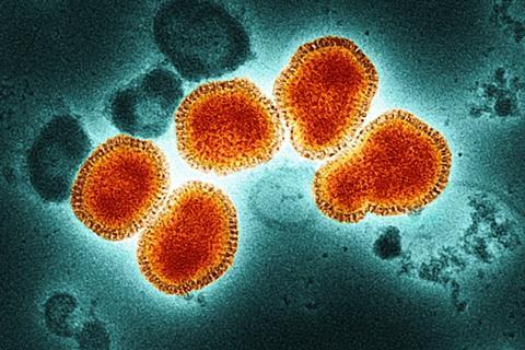 Influenza_A_Virus_(H3N2)_(52747876754)