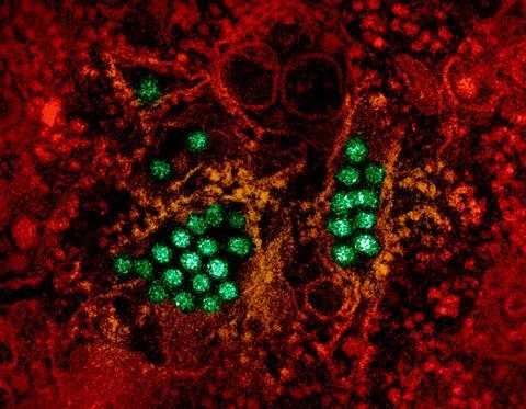 Dengue_Virus_Particles_(53231045112)