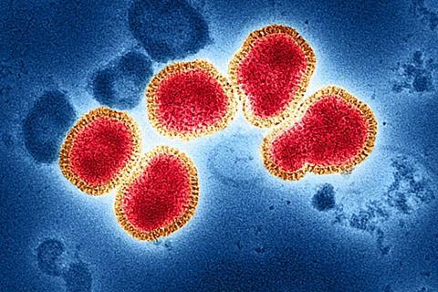 Influenza_A_Virus_(H3N2)_(52736747256)
