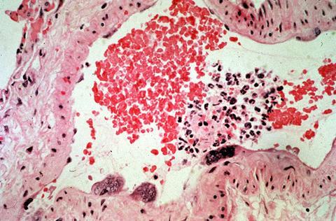 CSIRO_ScienceImage_321_Cross_Section_of_Blood_Vessel_With_Hendra_Virus