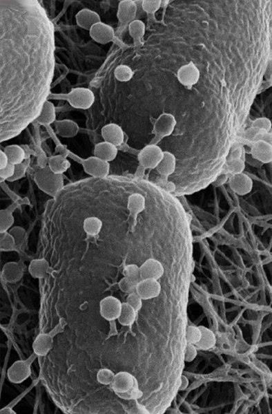 Escherichia_coli_with_phages