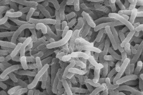 Cholera_bacteria_SEM (2)