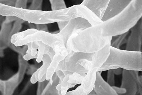 Rhizopus_oligosporus_2