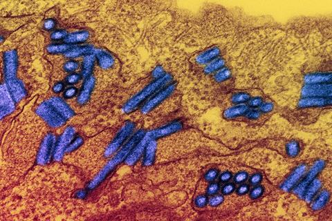 Colorized_transmission_electron_micrograph_of_rabies_virus_particles_(green)_image_captured_at_the_NIAID_Integrated_Research_Facility_in_Fort_Detrick,_Maryland_-_4