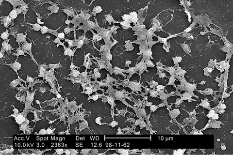 Staphylococcus_on_catheter