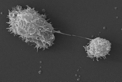 Acanthamoeba_polyphaga_PHIL11892.tif