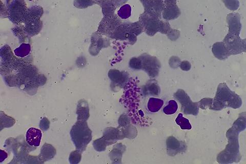 Amastigotes_of_Leishmania_donovani