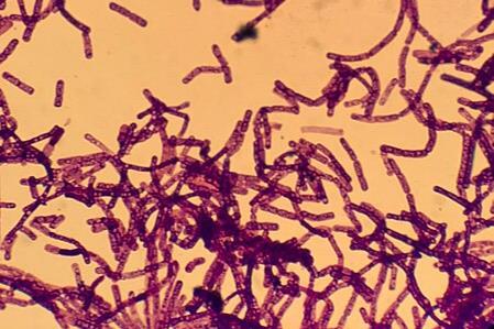 Xanthomonas_Campestris_under_the_miscroscope